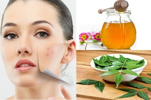 Simple Home Remedies For Beauty problems