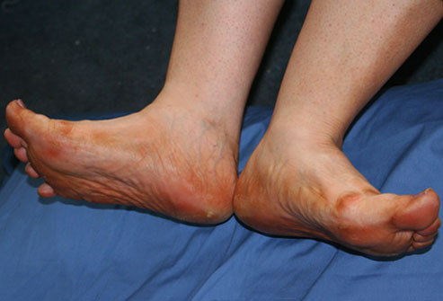 Look At Your Feet To Check If Your Healthy