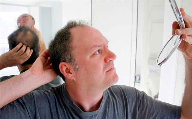 Home Remedies To Grow Hair On the Bald Head