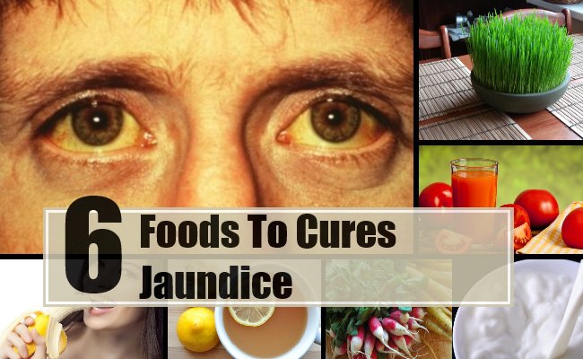 8 Foods That Cure Jaundice